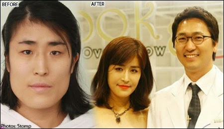 Amazing Plastic Surgery Makes A Korean Woman So Gorgeous 