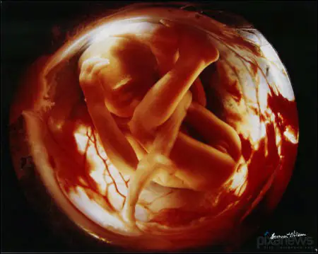 Foetus Growing In The Womb