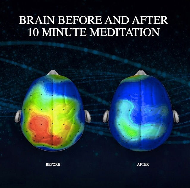 Meditation Brain