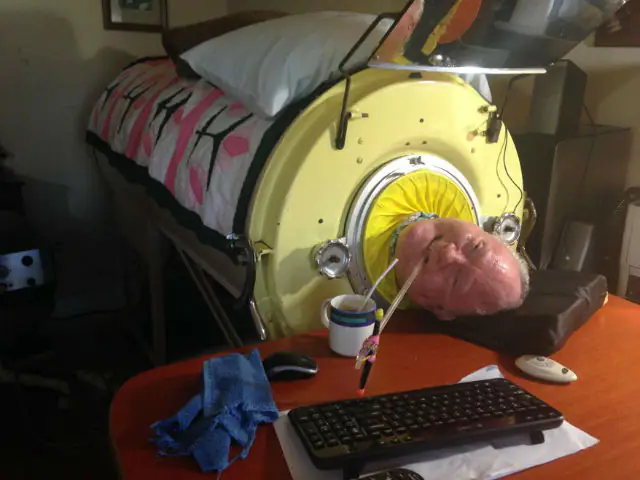 Paul Alexander , This man uses iron lung to breathe