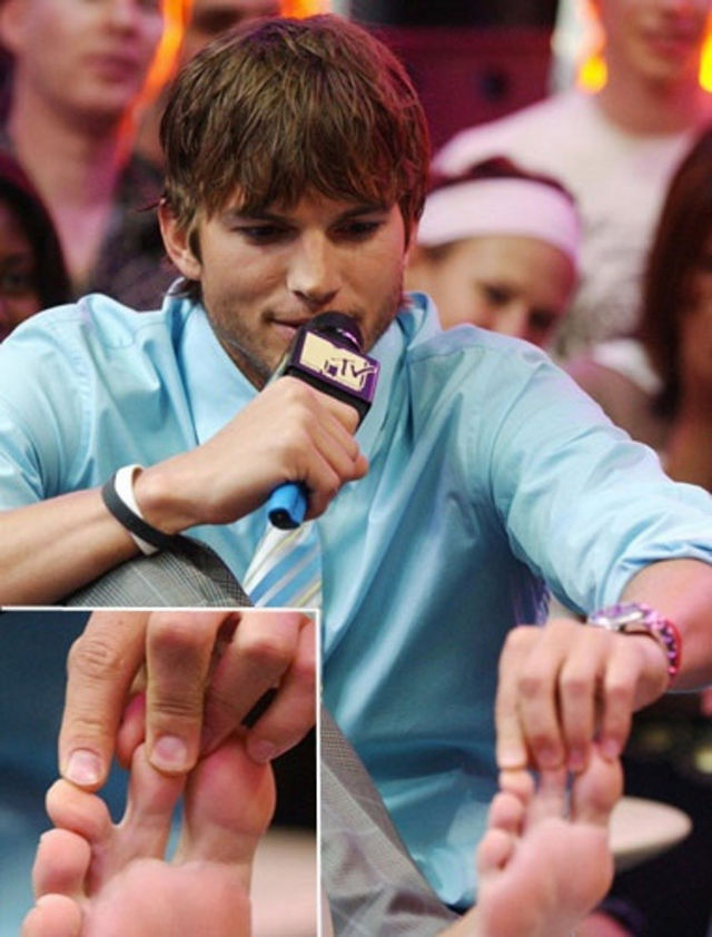 Ashton Kutcher - Webbed toes