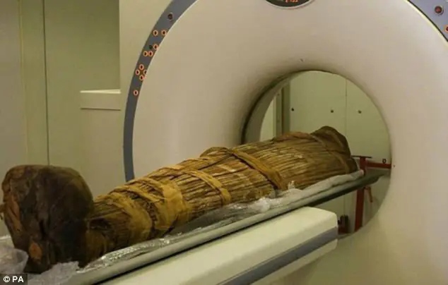 Facts About Mummies, Clogged Arteries in Mummies