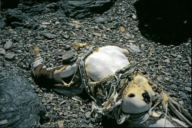 George Mallory, one of the world's best preserved bodies