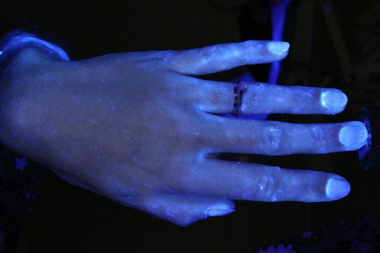 Hands and Hygiene - Tested with Glo Germ Gel Under UV Light (5)