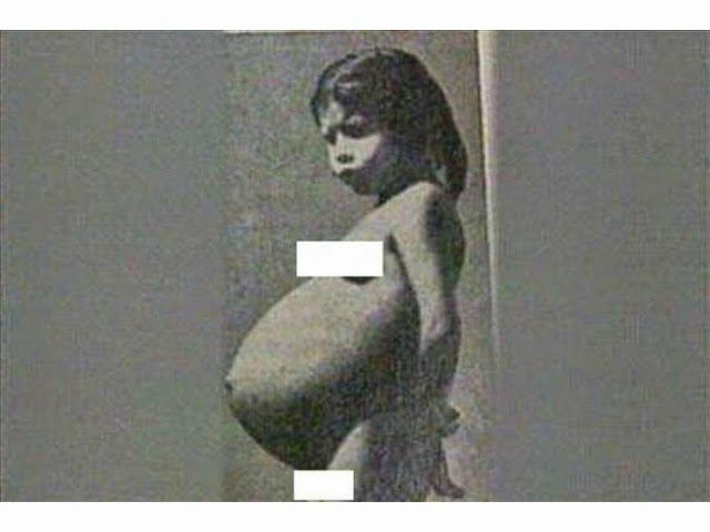 Lina Medina Pregnant
