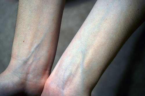 Blue vein
