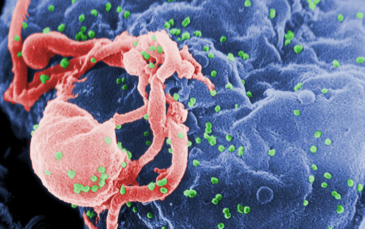 HIV and Post Exposure Prophylaxis