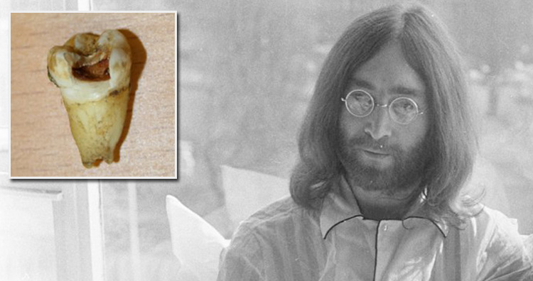 John Lennon Tooth
