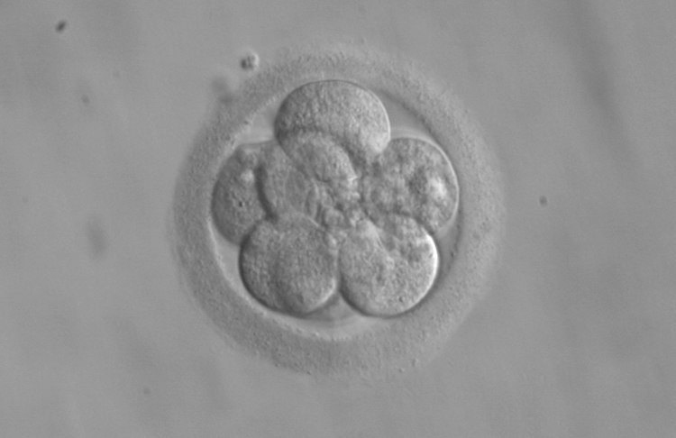 Frozen Embryo with Eight Cells
