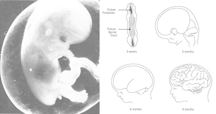 Human Brain During Gestation