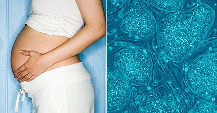 Pregnant Women and Embryonic Stem Cells