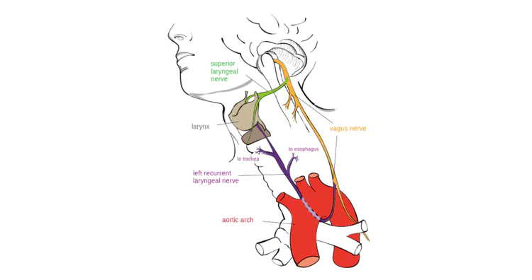 Drawing of the left recurrent laryngeal nerve