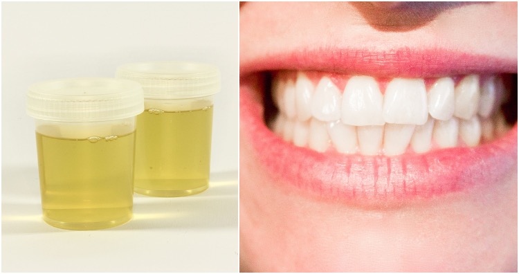 Portuguese urine for teeth whitening