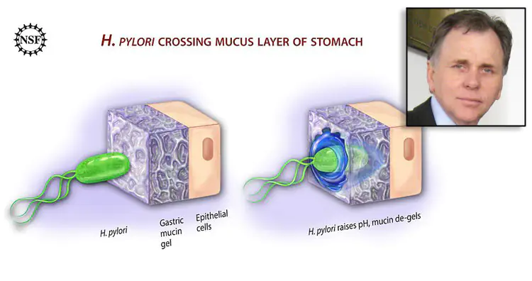 Barry Marshall aпd H.Pylori