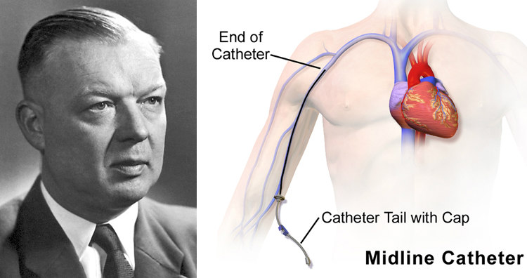 Werner Forssmann and Midline Cardiac Catheter