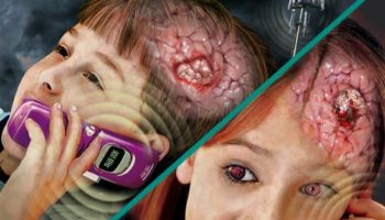 Picture Brain Tumor Risk Increase By 290% After 10 Years of Cellphone Use.