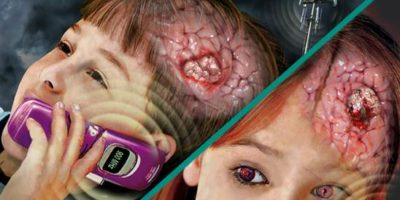 Picture Brain Tumor Risk Increase By 290% After 10 Years of Cellphone Use.