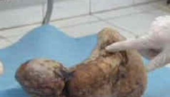 Picture A Woman Who Gave Birth to a Mummy