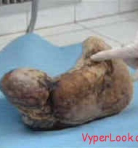 Picture A Woman Who Gave Birth to a Mummy