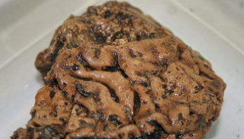 Picture Astounding Discovery Of 2684 Years Old Human Brain.