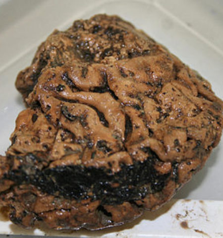 Picture Astounding Discovery Of 2684 Years Old Human Brain.