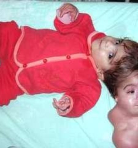 Picture Egyptian Girl With 2 Two Heads and One Body- Unbelievably tragic!
