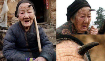 Picture 8 Diseases You Could Have And Not Even Know It!