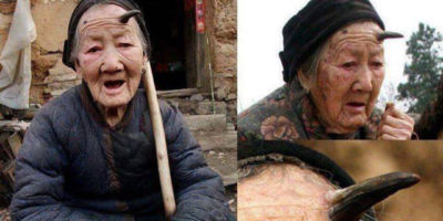 Picture 8 Diseases You Could Have And Not Even Know It!