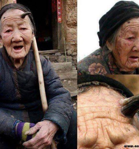 Picture 8 Diseases You Could Have And Not Even Know It!