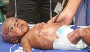 Picture Rahul – The Baby Who Suddenly Catches Himself On Fire