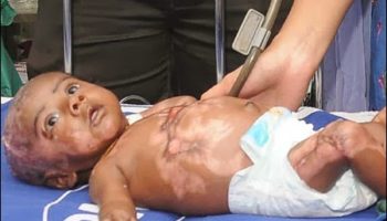 Picture Rahul – The Baby Who Suddenly Catches Himself On Fire