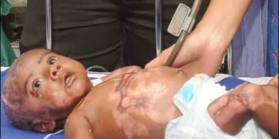 Picture Rahul – The Baby Who Suddenly Catches Himself On Fire