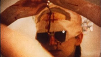 Picture The Woman Who Drilled A Hole In Her Head To Open Up Her Mind