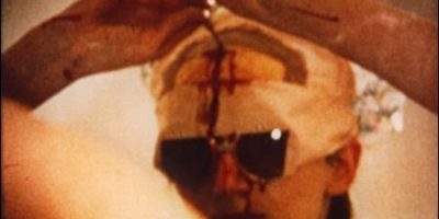 Picture The Woman Who Drilled A Hole In Her Head To Open Up Her Mind