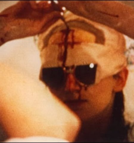 Picture The Woman Who Drilled A Hole In Her Head To Open Up Her Mind