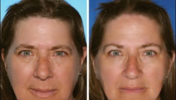 Picture Can You Spot The Smoker Between These Identical Twins?