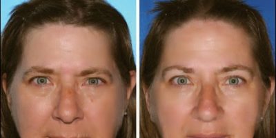 Picture Can You Spot The Smoker Between These Identical Twins?