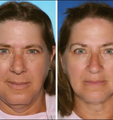 Picture Can You Spot The Smoker Between These Identical Twins?