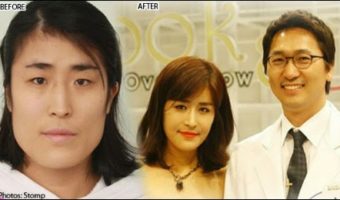 Picture Amazing Plastic Surgery Makes A Korean Woman So Gorgeous That Surgeon Proposes Her