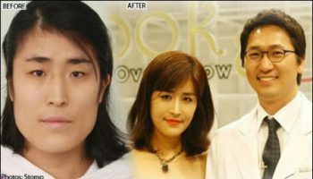 Picture Remarkable Plastic Surgery Transforms Korean Woman, Leading Her Surgeon to Propose