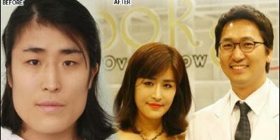 Picture Remarkable Plastic Surgery Transforms Korean Woman, Leading Her Surgeon to Propose