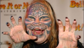 Picture Here Are Some Of The Weirdest Plastic Surgeries Guys Have Undergone