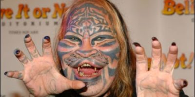 Picture Here Are Some Of The Weirdest Plastic Surgeries Guys Have Undergone