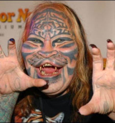 Picture Here Are Some Of The Weirdest Plastic Surgeries Guys Have Undergone