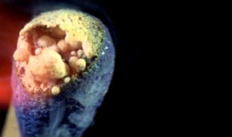 Picture This Video Of A Match Burning In Slow Motion Is A Must Watch