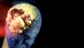 Picture This Video Of A Match Burning In Slow Motion Is A Must Watch