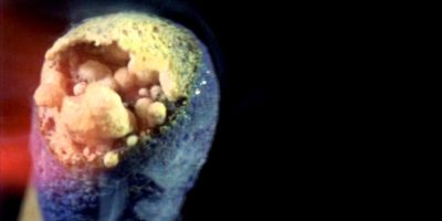 Picture This Video Of A Match Burning In Slow Motion Is A Must Watch