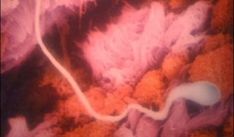 Picture Lennart Nilsson-A Swedish Photographer Spent 12 Years Of His Life Taking Pictures Of The Foetus Growing In The Womb