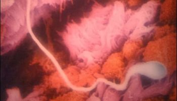 Picture Lennart Nilsson-A Swedish Photographer Spent 12 Years Of His Life Taking Pictures Of The Foetus Growing In The Womb