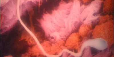 Picture Lennart Nilsson-A Swedish Photographer Spent 12 Years Of His Life Taking Pictures Of The Foetus Growing In The Womb